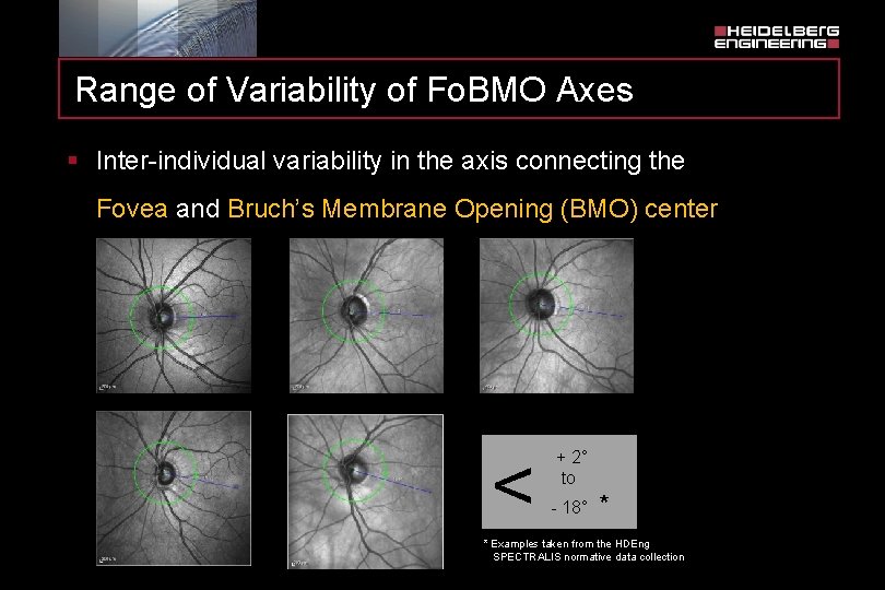 Range of Variability of Fo. BMO Axes § Inter-individual variability in the axis connecting