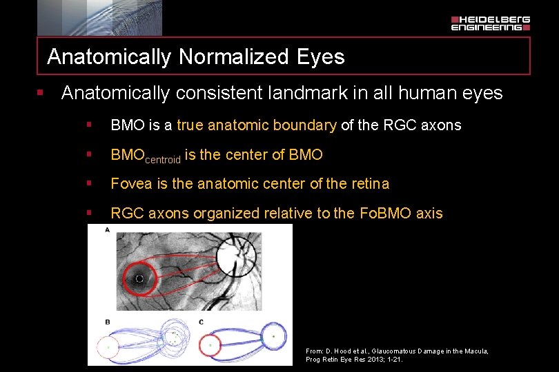 Anatomically Normalized Eyes § Anatomically consistent landmark in all human eyes § BMO is