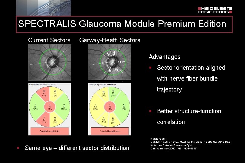 SPECTRALIS Glaucoma Module Premium Edition Garway-Heath Sectors ° 40 Current Sectors Advantages 110° °