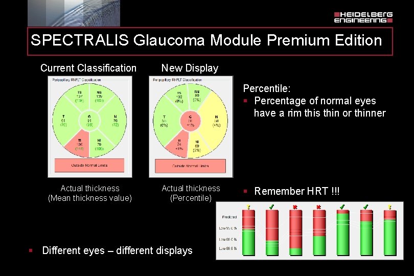 SPECTRALIS Glaucoma Module Premium Edition Current Classification New Display Percentile: § Percentage of normal