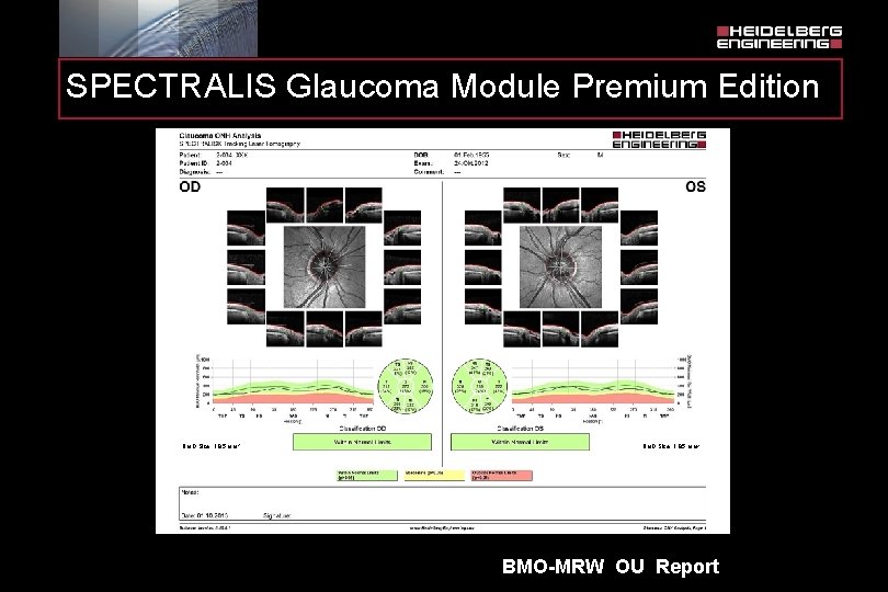 SPECTRALIS Glaucoma Module Premium Edition BMO Size: 1. 85 mm 2 BMO-MRW OU Report