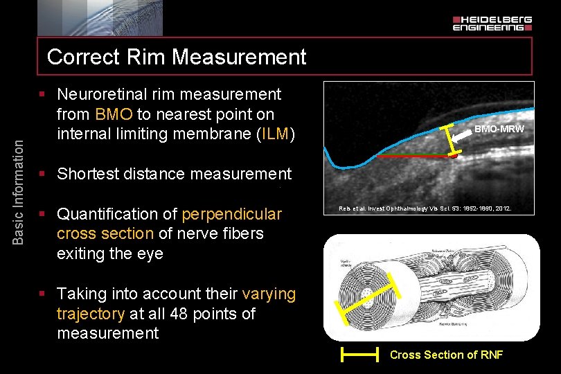 Basic Information Correct Rim Measurement § Neuroretinal rim measurement from BMO to nearest point