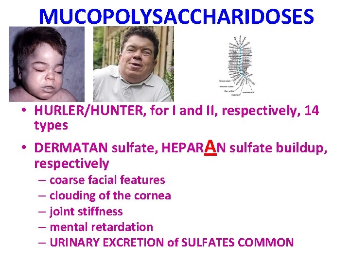 MUCOPOLYSACCHARIDOSES • HURLER/HUNTER, for I and II, respectively, 14 types • DERMATAN sulfate, HEPARAN