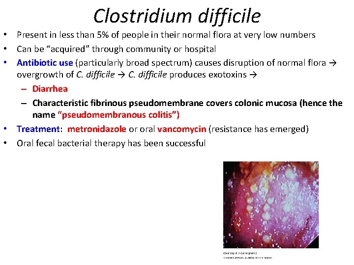 Clostridium difficile • Present in less than 5% of people in their normal flora