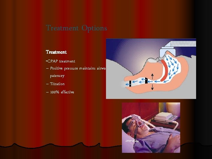Treatment Options Treatment -CPAP treatment – Positive pressure maintains airway patencey – Titration –