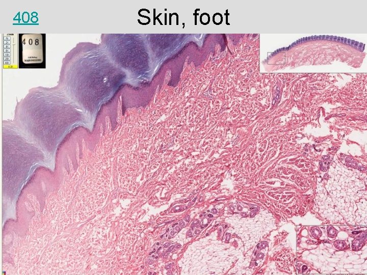 408 Skin, foot 