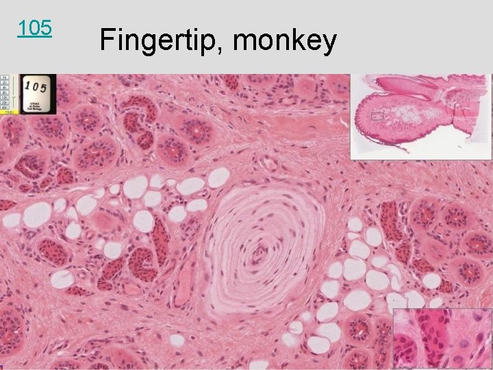 105 Fingertip, monkey 