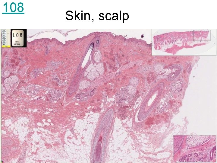 108 Skin, scalp 