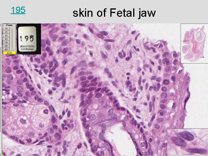 195 skin of Fetal jaw 