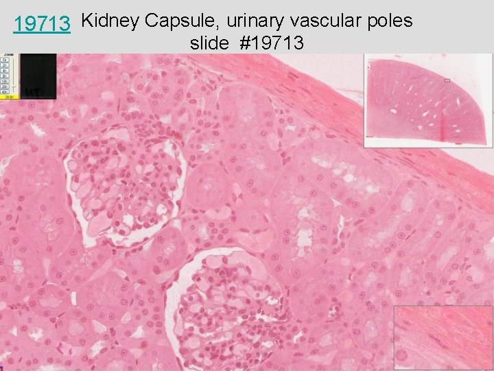 19713 Kidney Capsule, urinary vascular poles slide #19713 