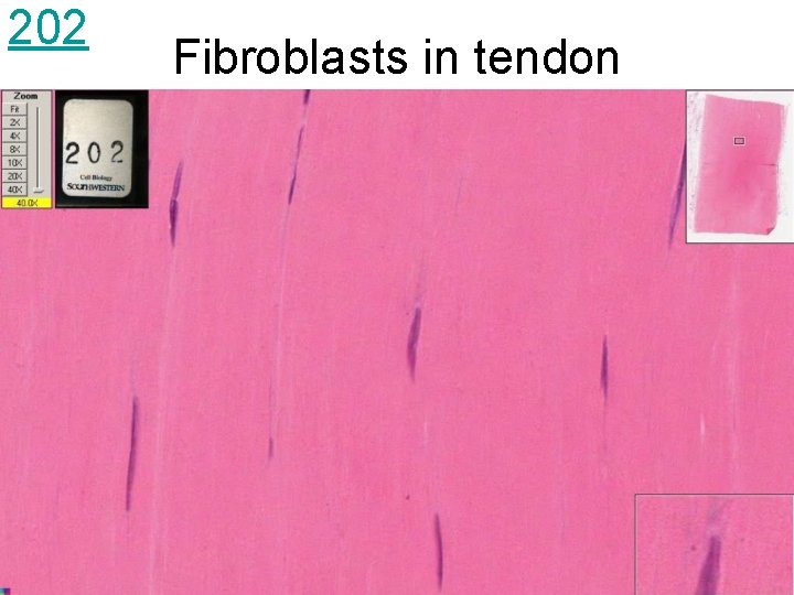 202 Fibroblasts in tendon 