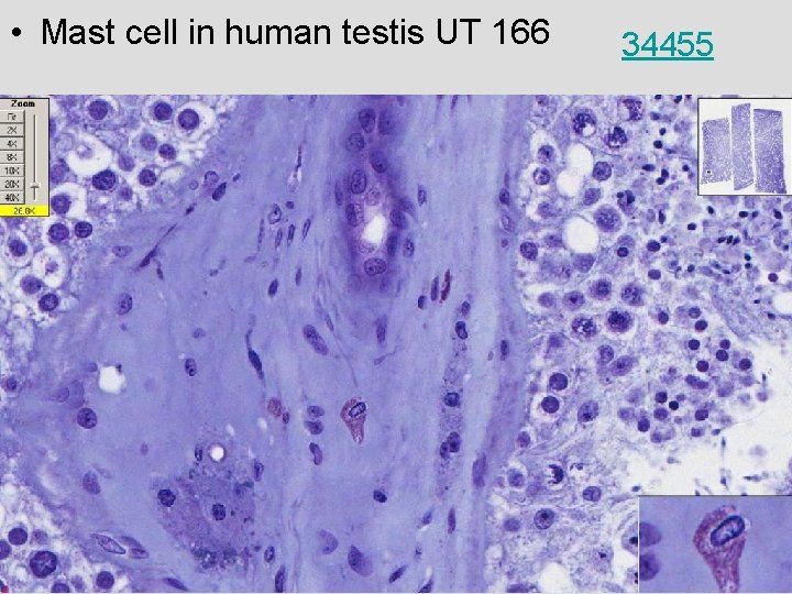  • Mast cell in human testis UT 166 34455 