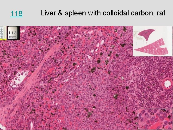 118 Liver & spleen with colloidal carbon, rat 