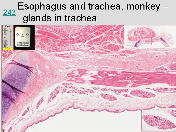 Esophagus and trachea, monkey – 242 glands in trachea 