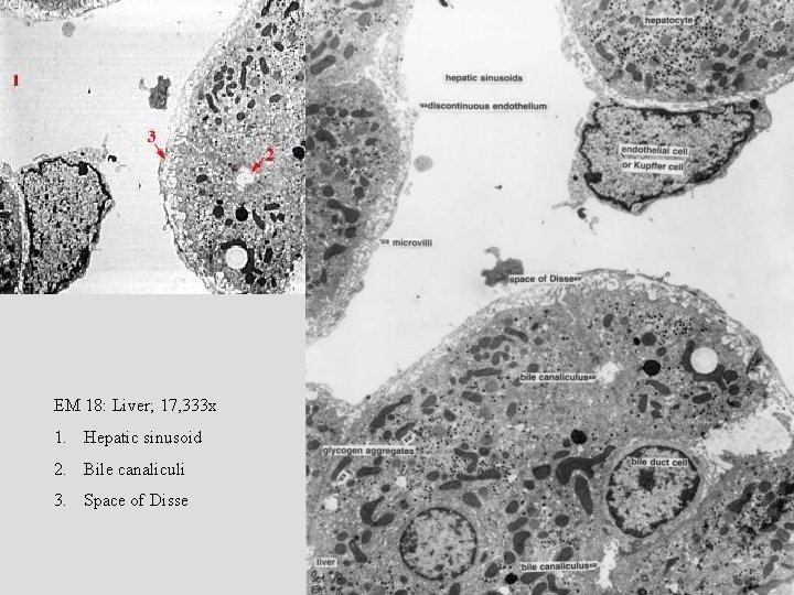 EM 18: Liver; 17, 333 x 1. Hepatic sinusoid 2. Bile canaliculi 3. Space