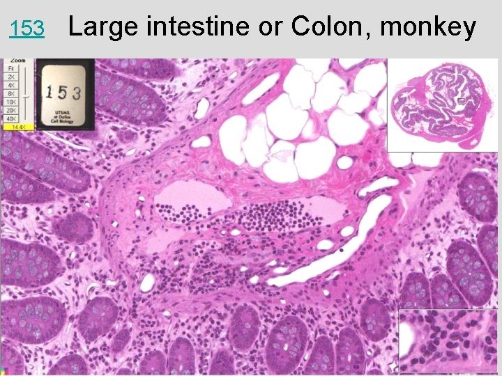 153 Large intestine or Colon, monkey 