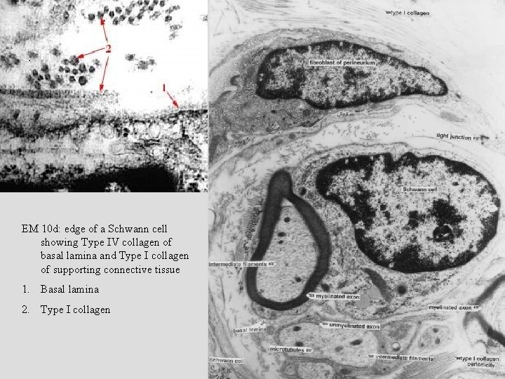 EM 10 d: edge of a Schwann cell showing Type IV collagen of basal