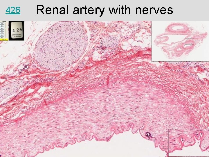 426 Renal artery with nerves 