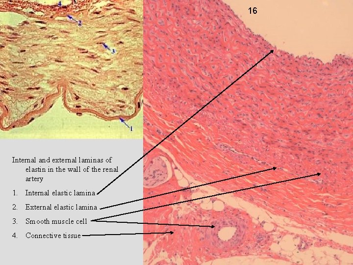 16 Internal and external laminas of elastin in the wall of the renal artery