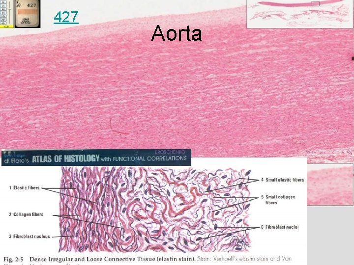 427 Aorta 