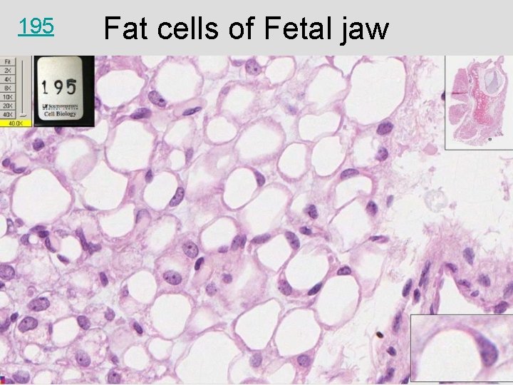 195 Fat cells of Fetal jaw 