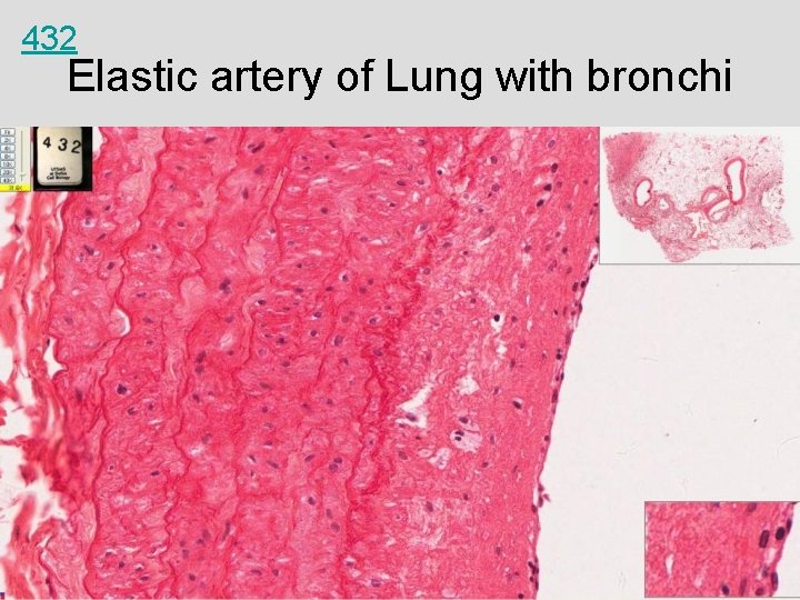 432 Elastic artery of Lung with bronchi 