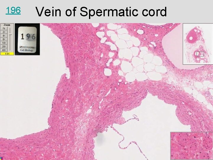 196 Vein of Spermatic cord 