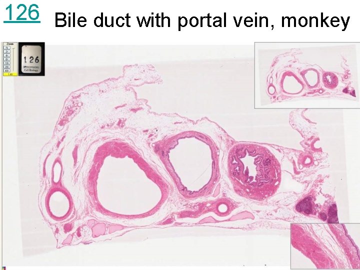 126 Bile duct with portal vein, monkey 