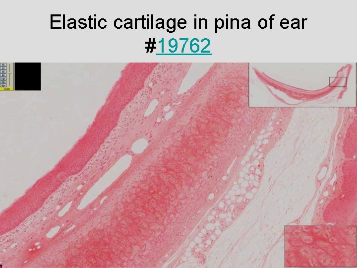 Elastic cartilage in pina of ear #19762 