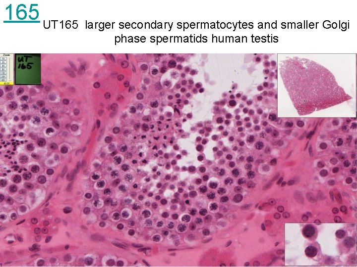 165 UT 165 larger secondary spermatocytes and smaller Golgi phase spermatids human testis 