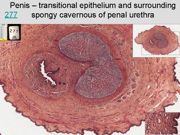 Penis – transitional epithelium and surrounding 277 spongy cavernous of penal urethra 