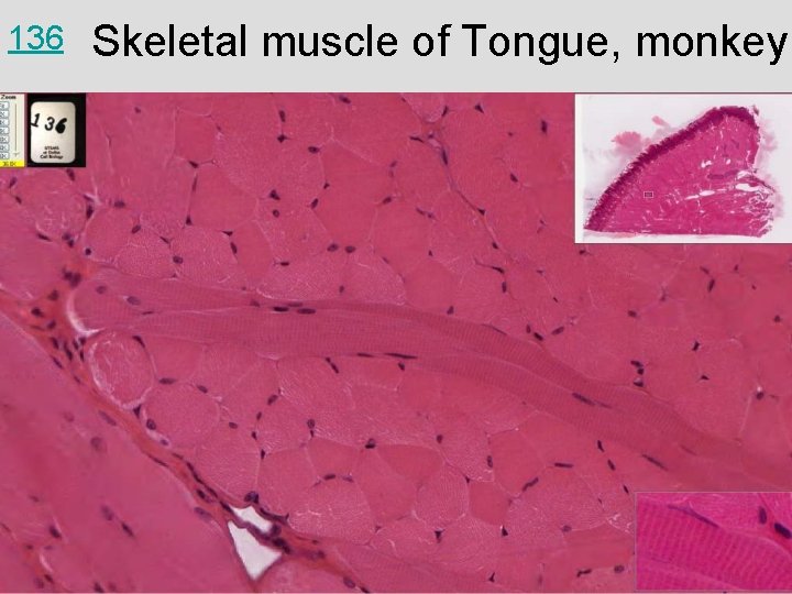 136 Skeletal muscle of Tongue, monkey 