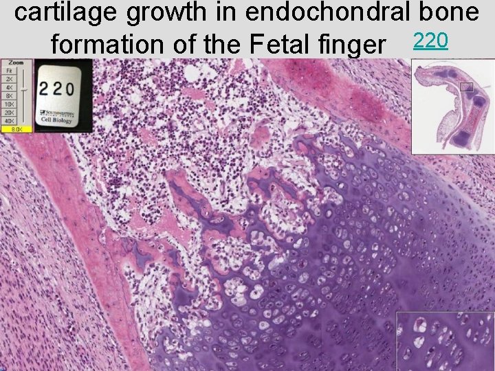 cartilage growth in endochondral bone formation of the Fetal finger 220 