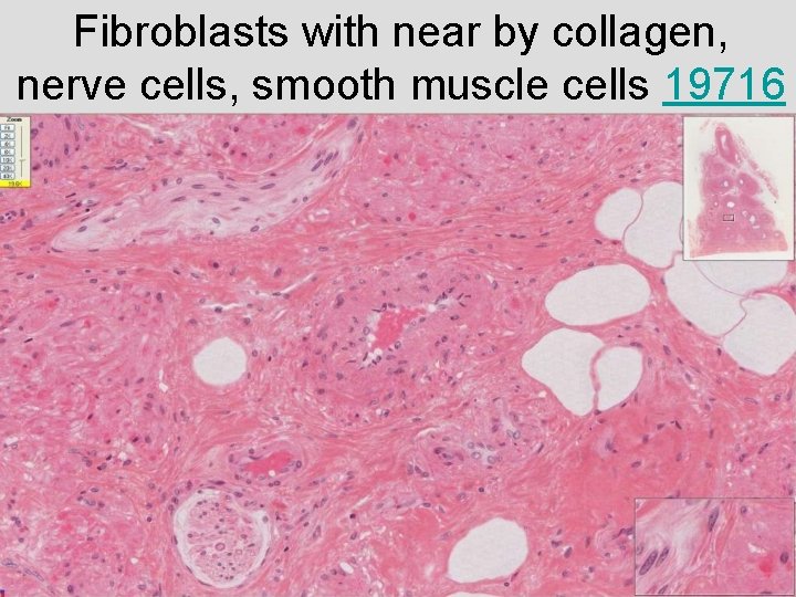 Fibroblasts with near by collagen, nerve cells, smooth muscle cells 19716 