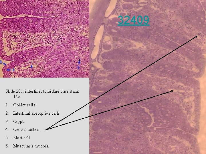 32409 • 32409 Slide 201: intestine, toluidine blue stain; 16 x 1. Goblet cells