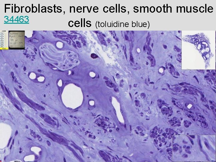 Fibroblasts, nerve cells, smooth muscle 34463 cells (toluidine blue) 