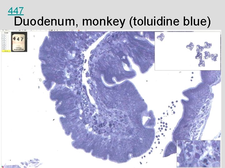 447 Duodenum, monkey (toluidine blue) 