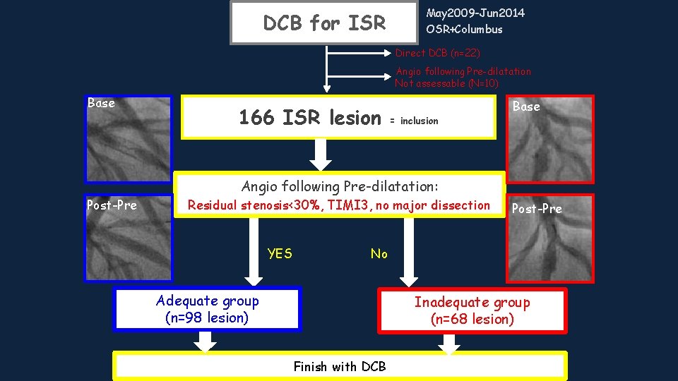 DCB for ISR May 2009 -Jun 2014 OSR+Columbus Direct DCB (n=22) Angio following Pre-dilatation