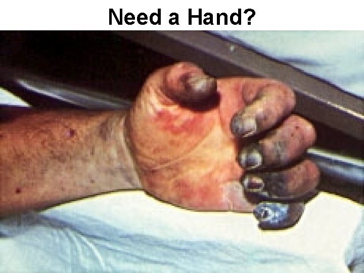 Need a Hand? 