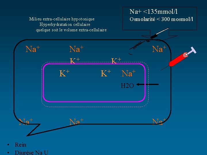 Na+ <135 mmol/l Osmolarité < 300 mosmol/l Milieu extra-cellulaire hypotonique Hyperhydratation cellulaire quelque soit