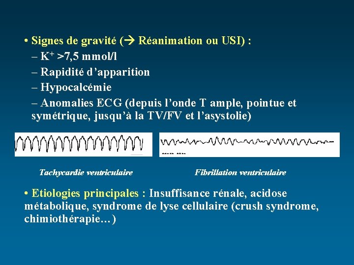  • Signes de gravité ( Réanimation ou USI) : – K+ >7, 5