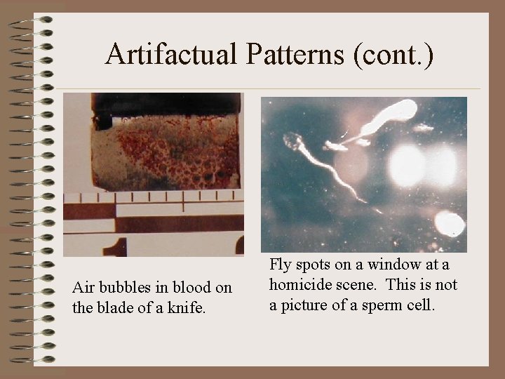 Artifactual Patterns (cont. ) Air bubbles in blood on the blade of a knife. Artifactual Patterns (cont. ) Air bubbles in blood on the blade of a knife.