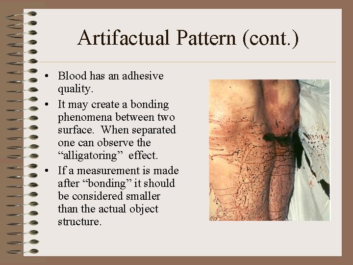 Artifactual Pattern (cont. ) • Blood has an adhesive quality. • It may create Artifactual Pattern (cont. ) • Blood has an adhesive quality. • It may create