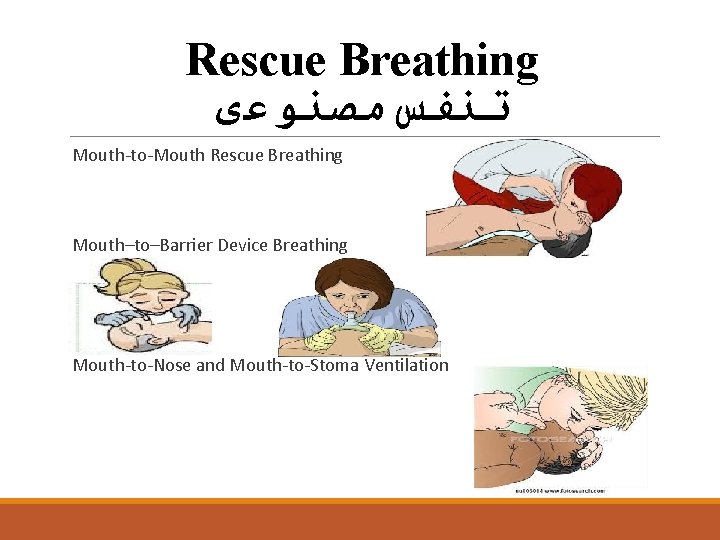 Rescue Breathing ﺗﻨﻔﺲ ﻣﺼﻨﻮﻋی Mouth-to-Mouth Rescue Breathing Mouth–to–Barrier Device Breathing Mouth-to-Nose and Mouth-to-Stoma Ventilation