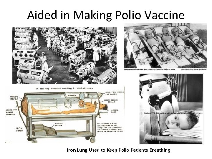 Aided in Making Polio Vaccine Iron Lung Used to Keep Polio Patients Breathing 