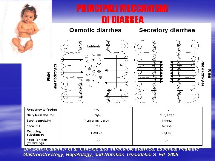 PRINCIPALI MECCANISMI DI DIARREA Da: Berni Canani R et al. Chronic and Intractable diarrhea.