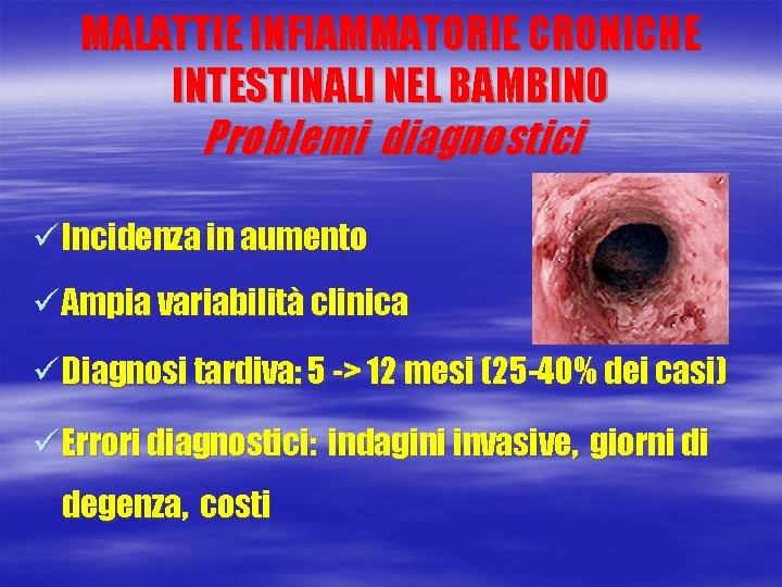 MALATTIE INFIAMMATORIE CRONICHE INTESTINALI NEL BAMBINO Problemi diagnostici ü Incidenza in aumento ü Ampia