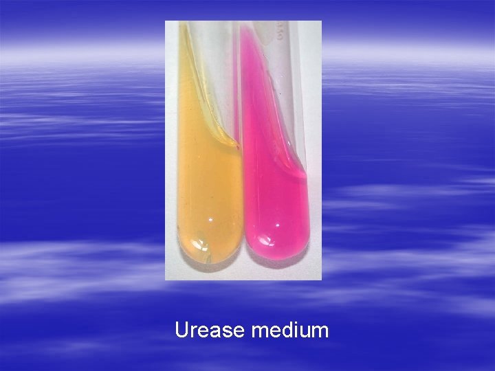 Urease medium 