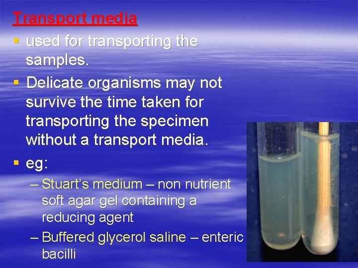 Transport media § used for transporting the samples. § Delicate organisms may not survive