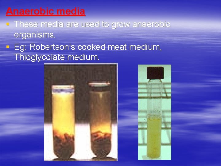 Anaerobic media § These media are used to grow anaerobic organisms. § Eg: Robertson’s